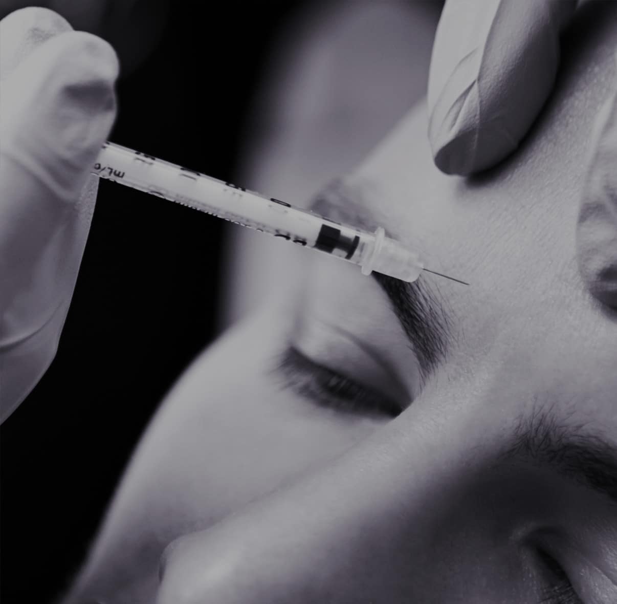 Injection de Botox - zones, indications, déroulé et prix d'une séance à Paris - Dr Liwarek